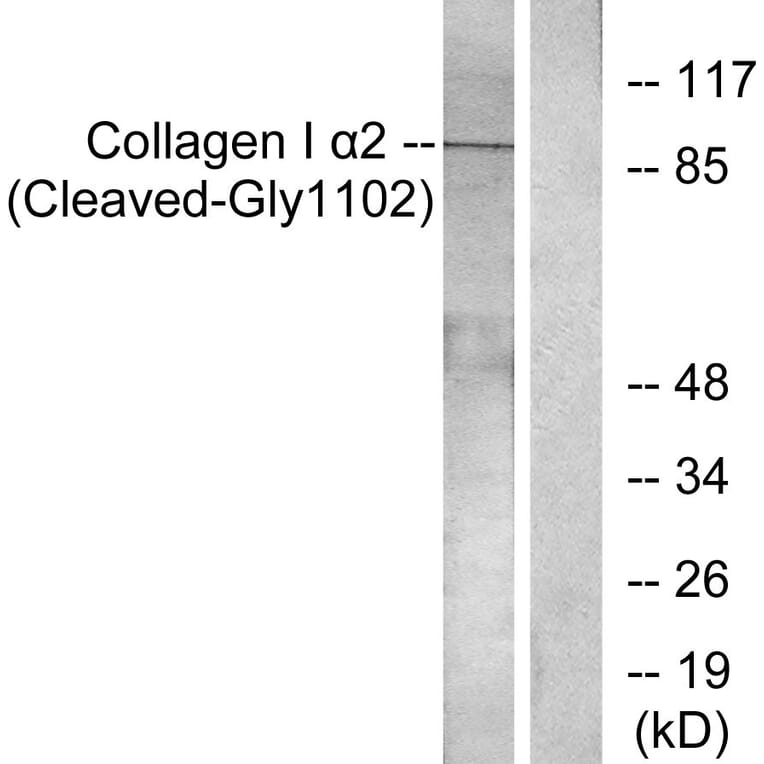 Western Blot - Anti-Collagen I alpha2 (cleaved Gly1102) Antibody (L0220) - Antibodies.com