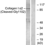 Western Blot - Anti-Collagen I alpha2 (cleaved Gly1102) Antibody (L0220) - Antibodies.com