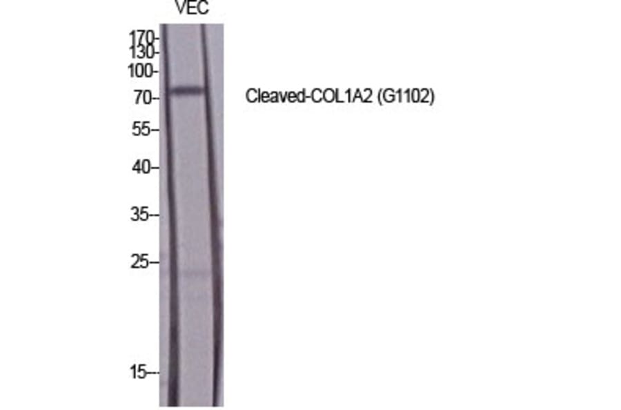 Western Blot - Anti-Collagen I alpha2 (cleaved Gly1102) Antibody (L0220) - Antibodies.com
