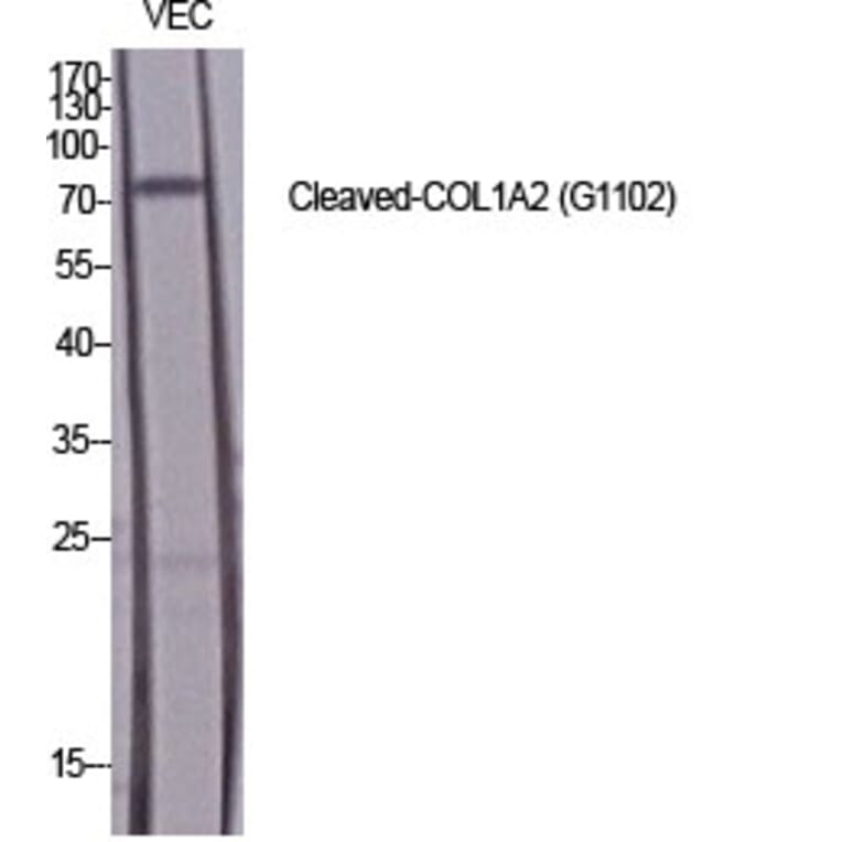 Western Blot - Anti-Collagen I alpha2 (cleaved Gly1102) Antibody (L0220) - Antibodies.com