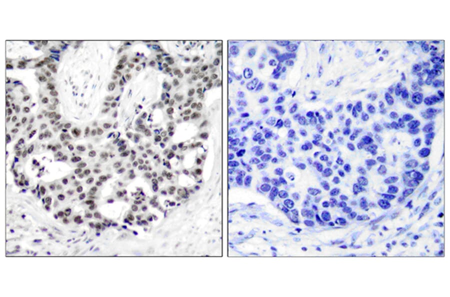 Immunohistochemistry - Anti-Androgen Receptor (phospho Ser650) Antibody (A7009) - Antibodies.com