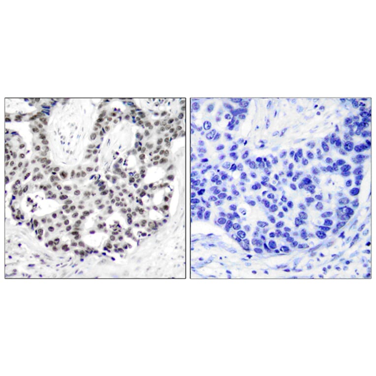 Immunohistochemistry - Anti-Androgen Receptor (phospho Ser650) Antibody (A7009) - Antibodies.com