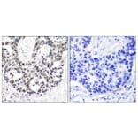Immunohistochemistry - Anti-Androgen Receptor (phospho Ser650) Antibody (A7009) - Antibodies.com