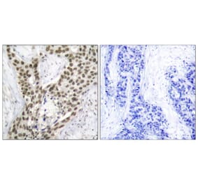 Immunohistochemistry - Anti-Androgen Receptor (phospho Ser213) Antibody (A7008) - Antibodies.com
