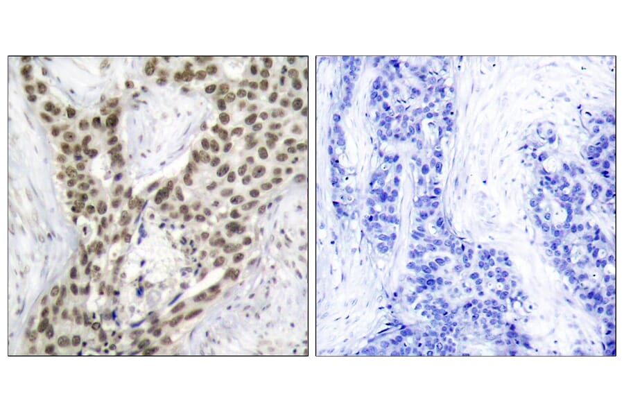 Immunohistochemistry - Anti-Androgen Receptor (phospho Ser213) Antibody (A7008) - Antibodies.com