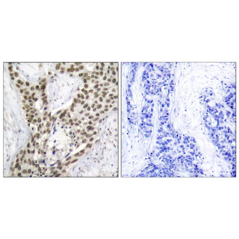 Immunohistochemistry - Anti-Androgen Receptor (phospho Ser213) Antibody (A7008) - Antibodies.com