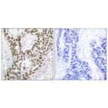 Immunohistochemistry - Anti-Androgen Receptor (phospho Ser213) Antibody (A7008) - Antibodies.com