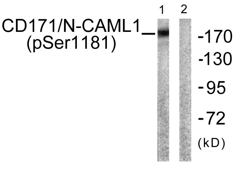 Western blot analysis of lysates from K562 cells using Anti-CD171 (phospho Ser1181) Antibody. The right hand lane represents a negative control, where the antibody is blocked by the immunising peptide.