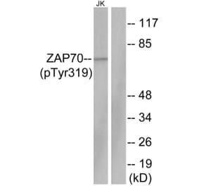 Western Blot - Anti-ZAP-70 (phospho Tyr319) Antibody (A7255) - Antibodies.com