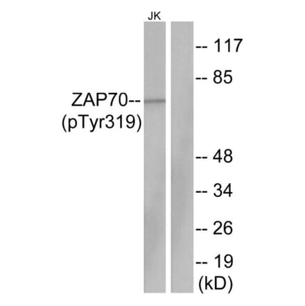 Western Blot - Anti-ZAP-70 (phospho Tyr319) Antibody (A7255) - Antibodies.com