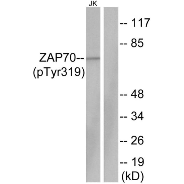 Western Blot - Anti-ZAP-70 (phospho Tyr319) Antibody (A7255) - Antibodies.com