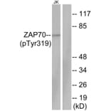 Western Blot - Anti-ZAP-70 (phospho Tyr319) Antibody (A7255) - Antibodies.com