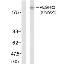 Western Blot - Anti-VEGFR2 (phospho Tyr951) Antibody (A7254) - Antibodies.com