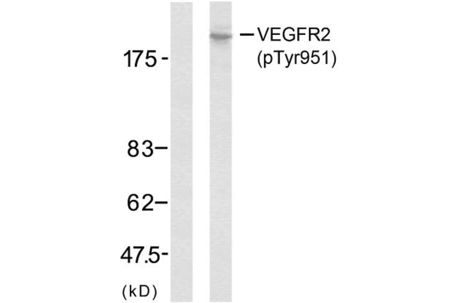 Western Blot - Anti-VEGFR2 (phospho Tyr951) Antibody (A7254) - Antibodies.com