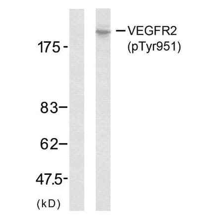 Western Blot - Anti-VEGFR2 (phospho Tyr951) Antibody (A7254) - Antibodies.com
