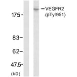 Western Blot - Anti-VEGFR2 (phospho Tyr951) Antibody (A7254) - Antibodies.com