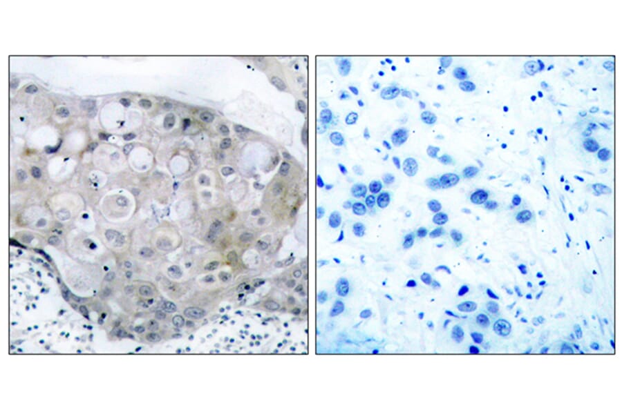 Immunohistochemistry - Anti-VEGFR2 (phospho Tyr951) Antibody (A7254) - Antibodies.com