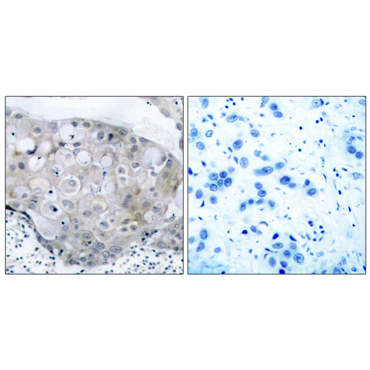 Immunohistochemistry - Anti-VEGFR2 (phospho Tyr951) Antibody (A7254) - Antibodies.com