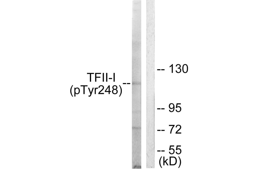 Western Blot - Anti-TFII-I (phospho Tyr248) Antibody (A0584) - Antibodies.com
