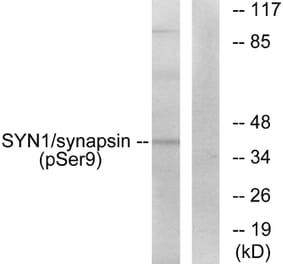 Western Blot - Anti-Synapsin (phospho Ser9) Antibody (A7233) - Antibodies.com