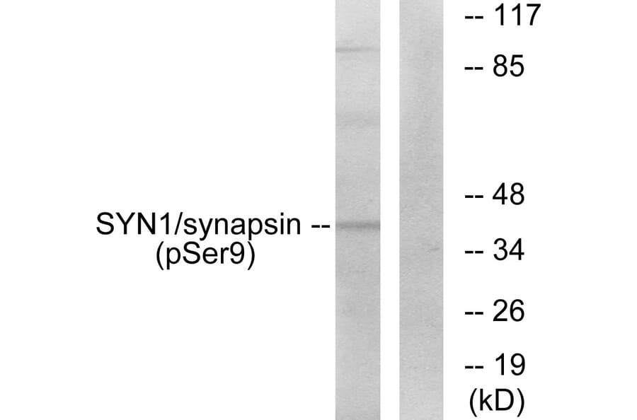Western Blot - Anti-Synapsin (phospho Ser9) Antibody (A7233) - Antibodies.com