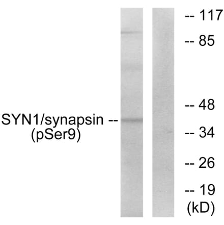 Western Blot - Anti-Synapsin (phospho Ser9) Antibody (A7233) - Antibodies.com