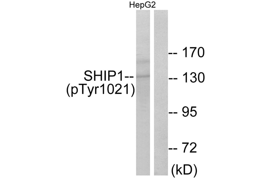 Western Blot - Anti-SHIP1 (phospho Tyr1021) Antibody (A0738) - Antibodies.com