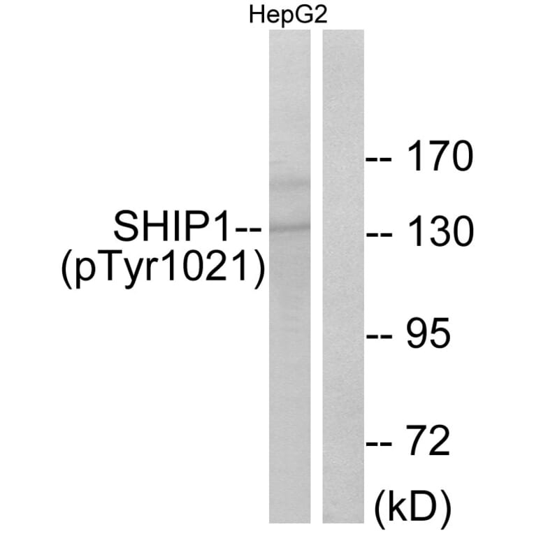Western Blot - Anti-SHIP1 (phospho Tyr1021) Antibody (A0738) - Antibodies.com