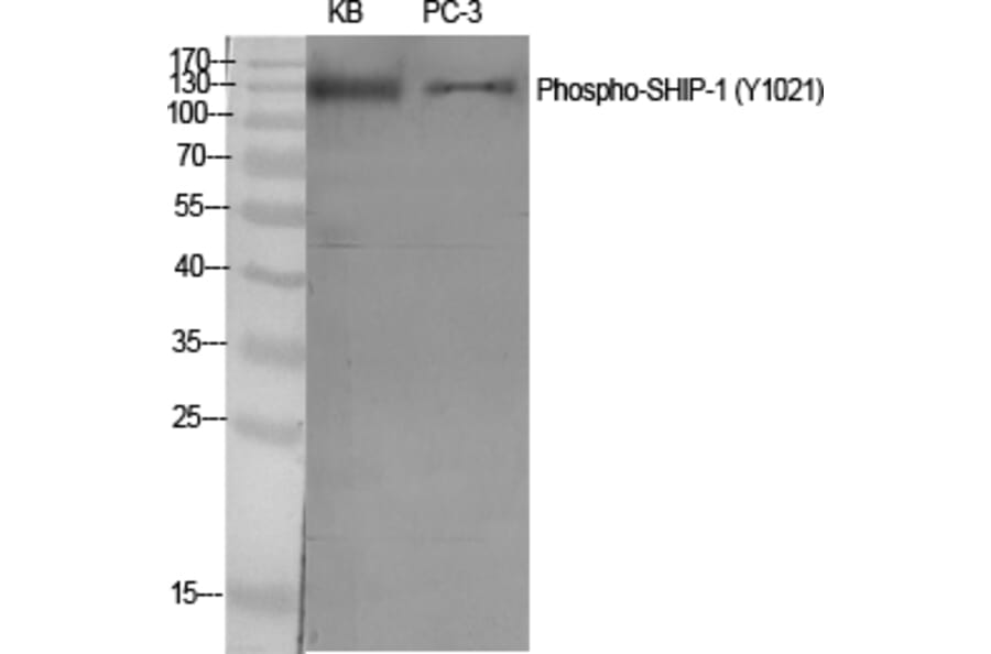 Western Blot - Anti-SHIP1 (phospho Tyr1021) Antibody (A0738) - Antibodies.com