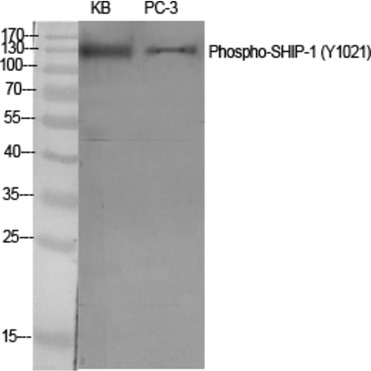 Western Blot - Anti-SHIP1 (phospho Tyr1021) Antibody (A0738) - Antibodies.com