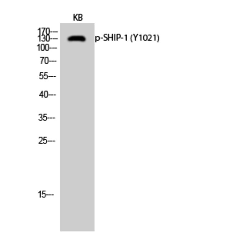 Western Blot - Anti-SHIP1 (phospho Tyr1021) Antibody (A0738) - Antibodies.com