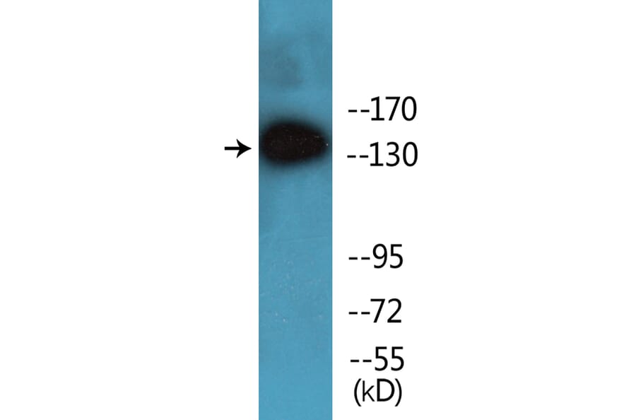Western Blot - Anti-SHIP1 (phospho Tyr1021) Antibody (P12-1176) - Antibodies.com
