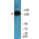 Western Blot - Anti-SHIP1 (phospho Tyr1021) Antibody (P12-1176) - Antibodies.com