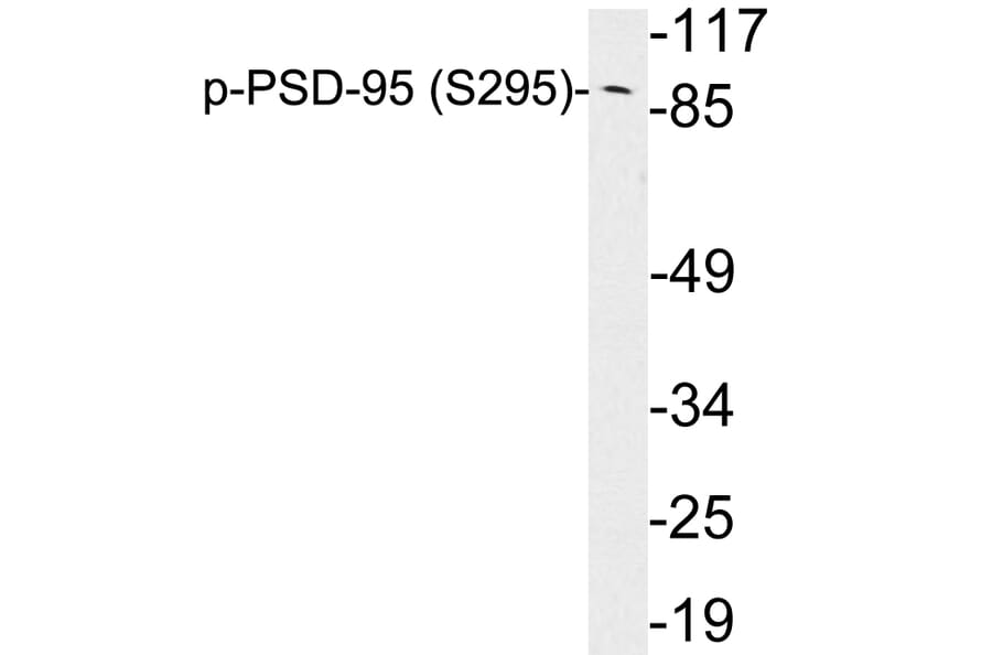 Western Blot - Anti-PSD-95 (phospho Ser295) Antibody (P12-1051) - Antibodies.com