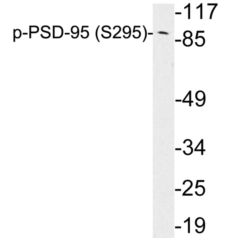 Western Blot - Anti-PSD-95 (phospho Ser295) Antibody (P12-1051) - Antibodies.com