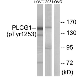 Western Blot - Anti-PLCG1 (phospho Tyr1253) Antibody (A0551) - Antibodies.com