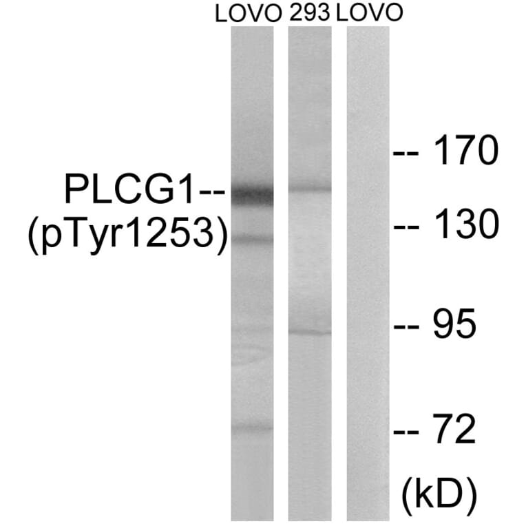 Western Blot - Anti-PLCG1 (phospho Tyr1253) Antibody (A0551) - Antibodies.com