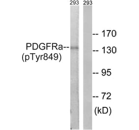 Western Blot - Anti-PDGFRa (phospho Tyr849) Antibody (A8210) - Antibodies.com