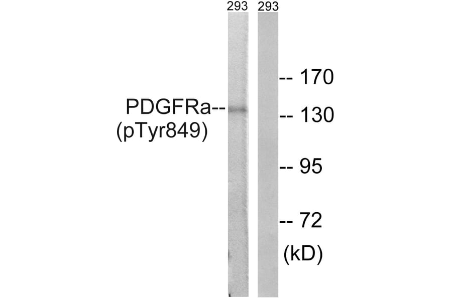 Western Blot - Anti-PDGFRa (phospho Tyr849) Antibody (A8210) - Antibodies.com