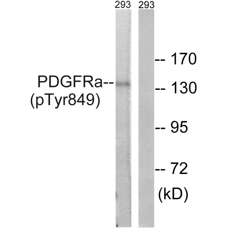 Western Blot - Anti-PDGFRa (phospho Tyr849) Antibody (A8210) - Antibodies.com