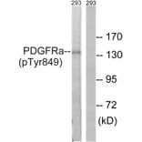 Western Blot - Anti-PDGFRa (phospho Tyr849) Antibody (A8210) - Antibodies.com