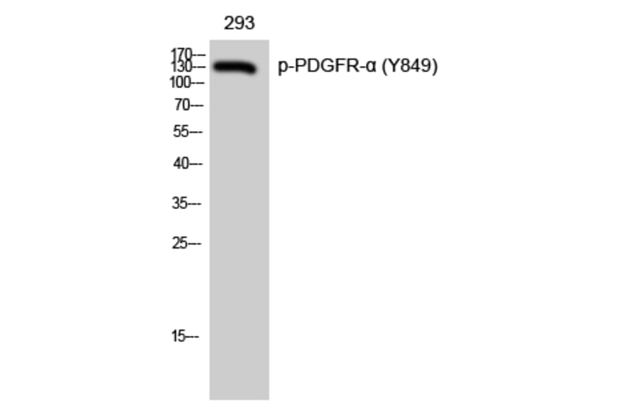 Western Blot - Anti-PDGFRa (phospho Tyr849) Antibody (A8210) - Antibodies.com