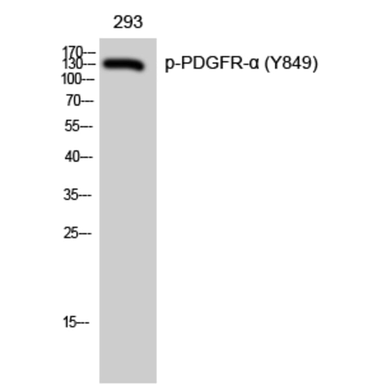 Western Blot - Anti-PDGFRa (phospho Tyr849) Antibody (A8210) - Antibodies.com