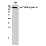 Western Blot - Anti-PDGFRa (phospho Tyr849) Antibody (A8210) - Antibodies.com