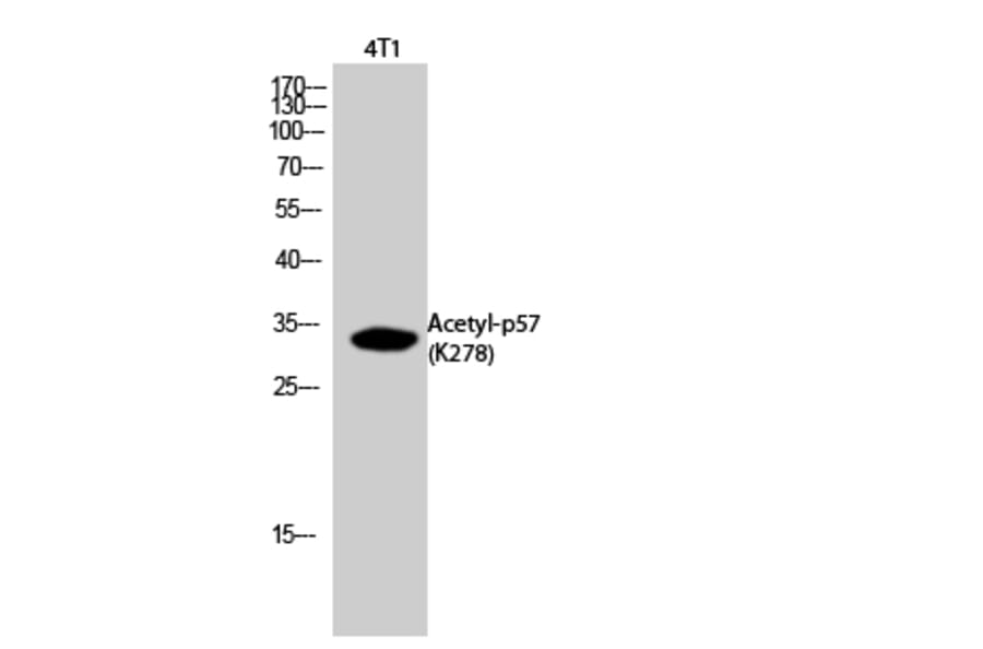 Western Blot - Anti-p57Kip2 (acetyl Lys278) Antibody (D12175) - Antibodies.com