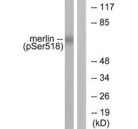 Western Blot - Anti-Merlin (phospho Ser518) Antibody (A7150) - Antibodies.com