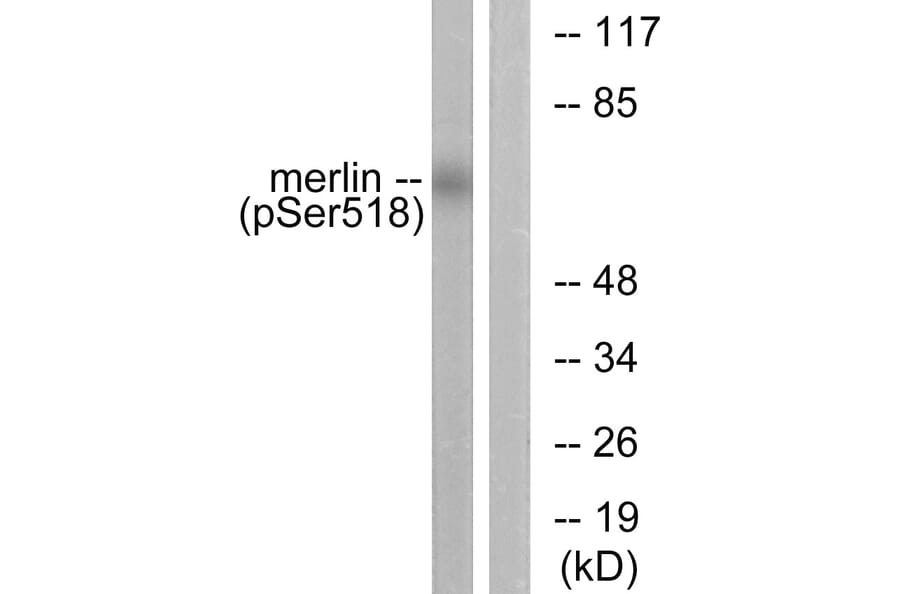Western Blot - Anti-Merlin (phospho Ser518) Antibody (A7150) - Antibodies.com