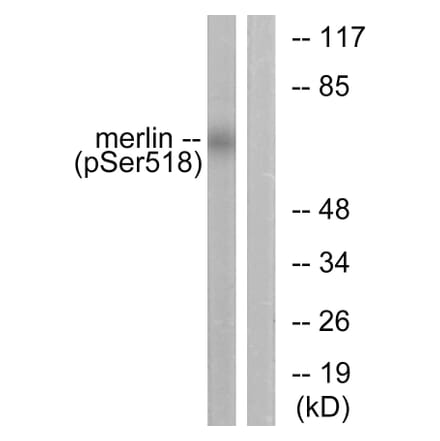 Western Blot - Anti-Merlin (phospho Ser518) Antibody (A7150) - Antibodies.com
