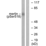 Western Blot - Anti-Merlin (phospho Ser518) Antibody (A7150) - Antibodies.com