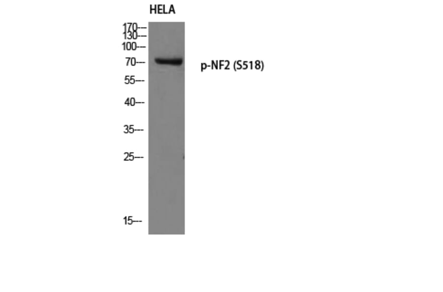 Western Blot - Anti-Merlin (phospho Ser518) Antibody (A7150) - Antibodies.com